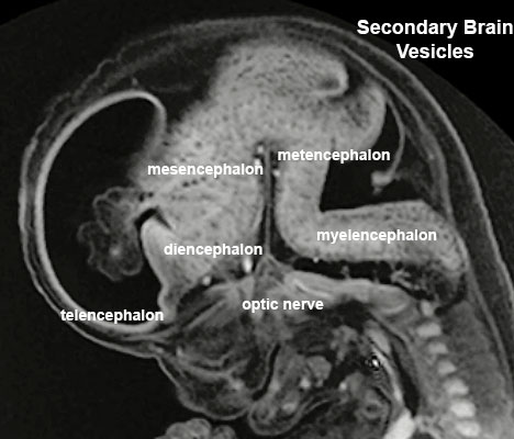File:Stage23 MRI S01-vesicles.jpg
