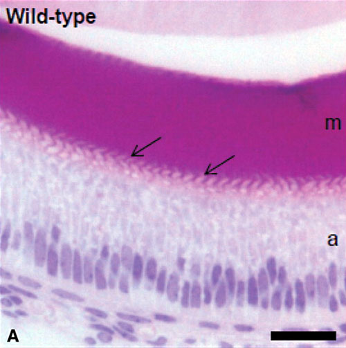 File:Mouse- tooth histology.jpg