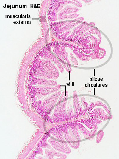 File:Intestine histology 003.jpg