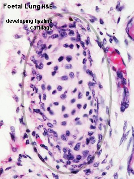 File:Fetal lung histology 02.jpg