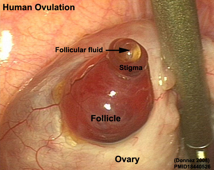 File:Human ovulation 06.jpg
