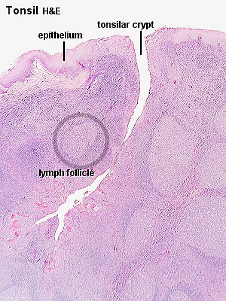 File:Tonsil histology 01.jpg - Embryology