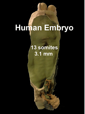File:Embryo 3.1mm-1.gif