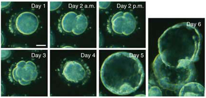 File:Human blastocyst day 1-6.jpg