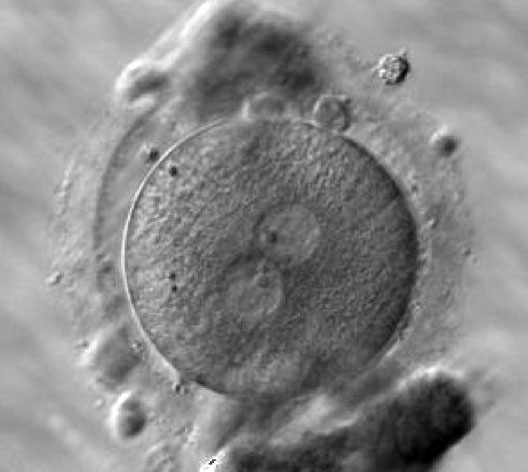 File:Human zygote two pronuclei 01.jpg - Embryology