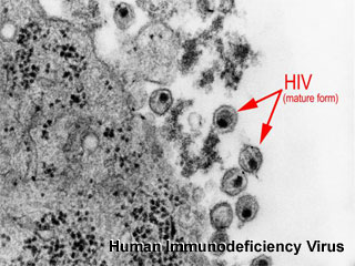 File:Human immunodeficiency virus.jpg