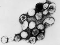 Rubella Virus EM
