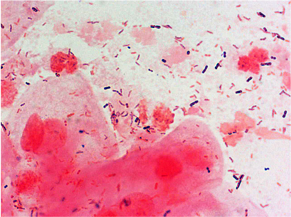 File:Bacteria - gram-stained vaginal smear 09.jpg - Embryology