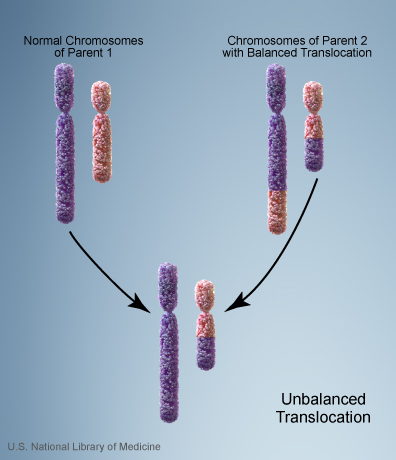 File:Chromosome- unbalanced translocation.jpg