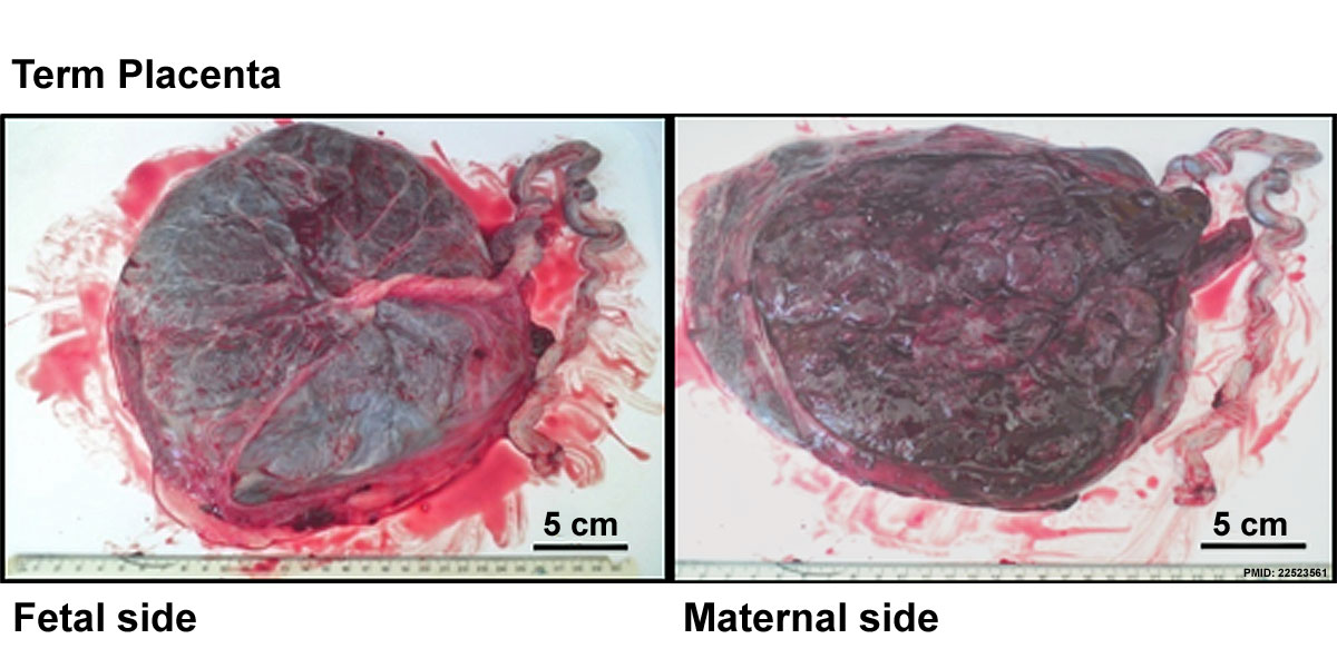 File:Placenta term anatomy 01.jpg - Embryology