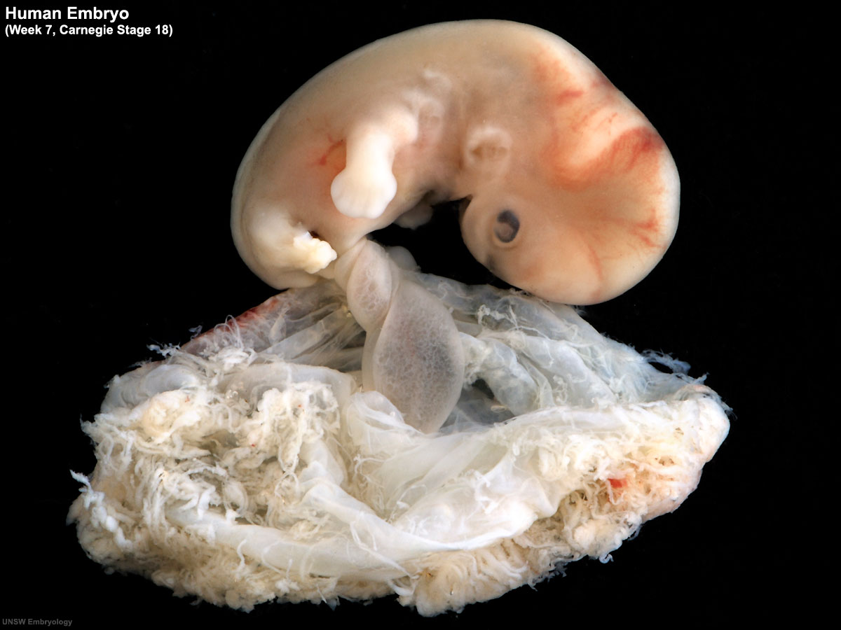 File:Stage18 bf11.jpg - Embryology