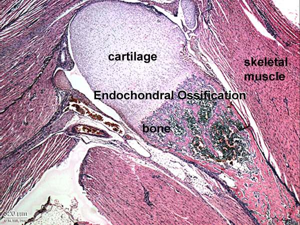 File:Endochondral bone.jpg - Embryology