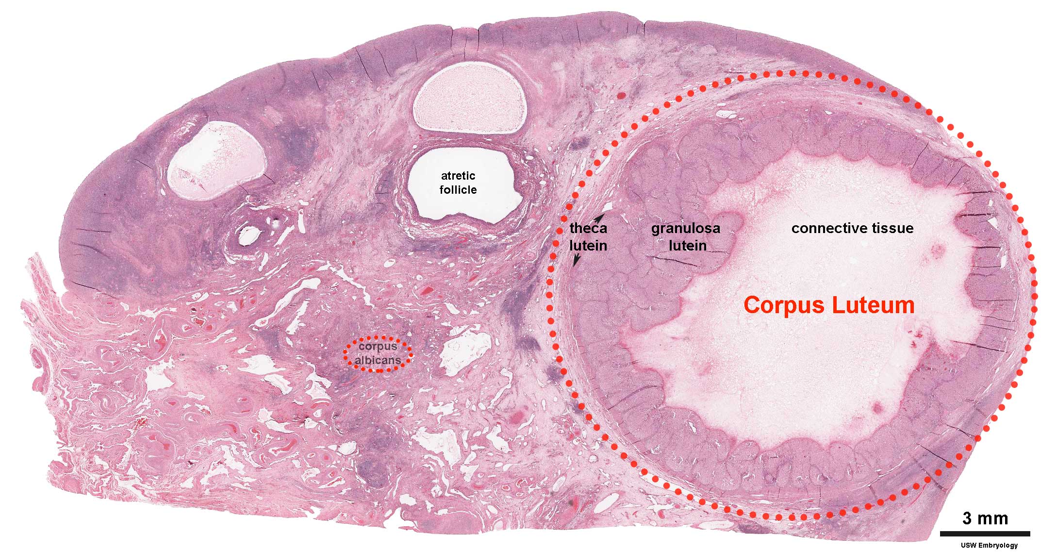 In the mature or graafian follicle of the ovary