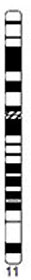 File:Human idiogram-chromosome 11.jpg