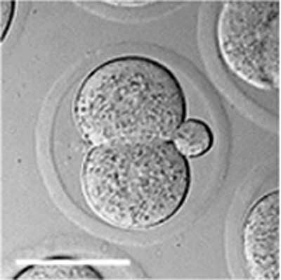 File:Mouse-2 cell 01.jpg