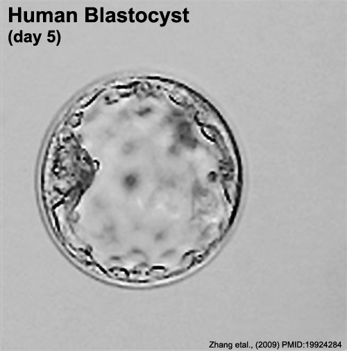 Human embryo day 5 label.gif