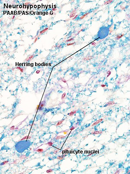 File:Pituitary histology 003.jpg