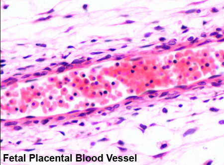 File:Placenta blood.jpg