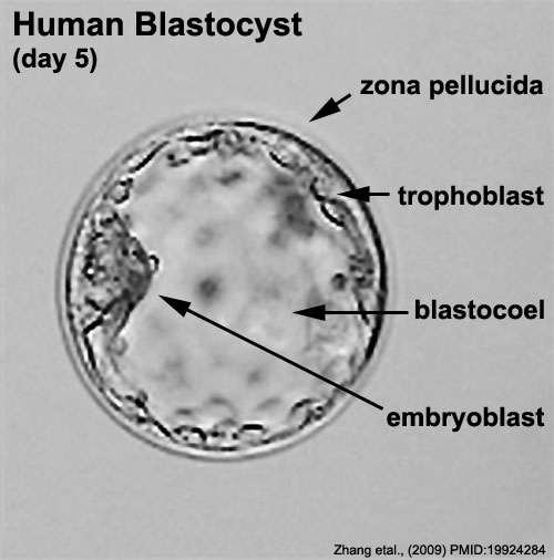 File:Human embryo day 5 label.jpg