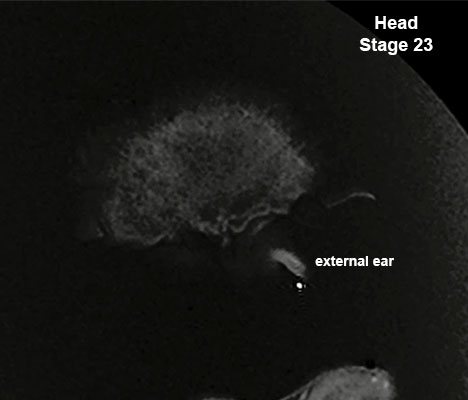 File:Stage23 MRI S01-ear.jpg
