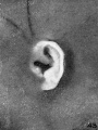 Fig. 43. Embryo No. 2328, 65 mm.