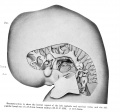 Plate 5. Reconstruction to show the lateral aspect of the left cephalic and cervical veins