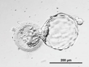 Human blastocyst "hatching" from the zona pellucida