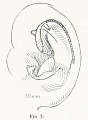 Fig. 7. Auricular cartilage 50 mm fetus