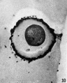FIG. 10. Ovarian egg from unmated doe, inseminated with normal sperm in vitro. Sperm penetration has occurred. Note sperm head at lower right periphery.