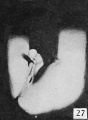 Fig. 27. No. 693, 45 mm., male. X 4.
