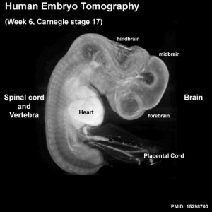 Carnegie stage 17 - Embryology