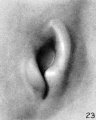 Fig. 23. Embryo No. Template:CE547, 18 mm. long. X 22.