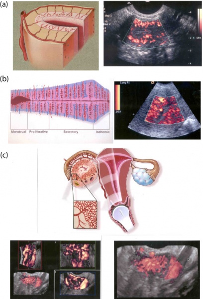 File:Ultrasound uterine and ovarian vascularity.jpg
