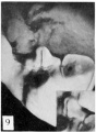 Fig. 9. Carnegie Embryo No. 28 Male