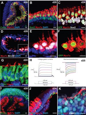 CHIR-treated aggregates give rise to inner ear organoids harboring mechanosensitive hair cells