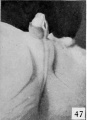 Fig. 47. No. 2026, 80-90 mm. (est.), male.