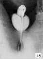 Fig. 48. No. 1705a, 83.2 mm., male. X 4.