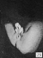 Fig. 25. Carnegie 652K, 44 mm Male