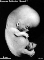 Embryo No. 8553 (right)