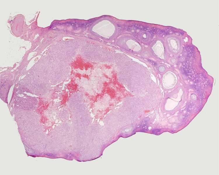 File:Ovary histology 004.jpg