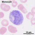 monocyte