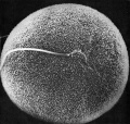 Hamster oocyte and spermatozoa