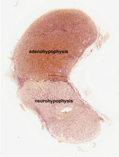 File:Pituitary histology 009.jpg