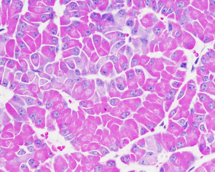 File:Pituitary histology 005.jpg