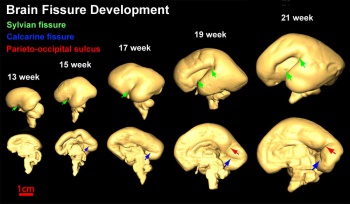 Neural System - Fetal - Embryology
