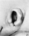 Fig. 21. Embryo No.492, 16.8 mm. long. X 27.