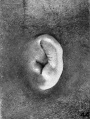 Fig. 44. Embryo No. 2118, 69 mm.