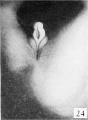 Fig. 24. Carnegie 948, 45 mm Male