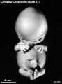 Embryo No. 8553 (front)