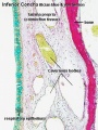 Nasal respiratory epithelium (inferior concha)